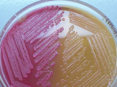 enterobacter macconkey|22.2: Selective and Differential Media .